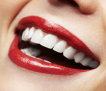 Benefits of visiting a Houston, TX area cosmetic dentist