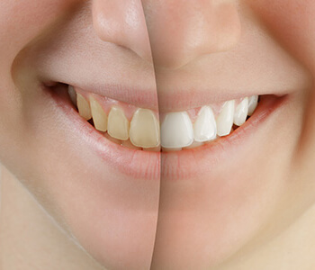 Patients find a dentist in Houston who provides the best cosmetic treatments for enhancing smiles