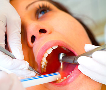 Houston area dentist explains crowns for teeth