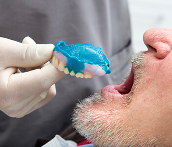 Dental team in Houston explains the reason for a temporary dental crown