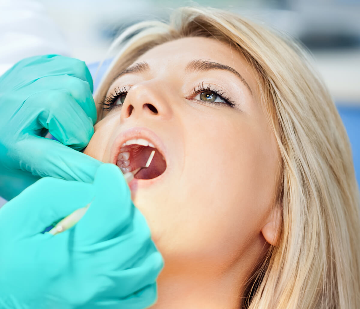 Explains the Signs of Periodontal Disease in Dentist in Houston, TX Area